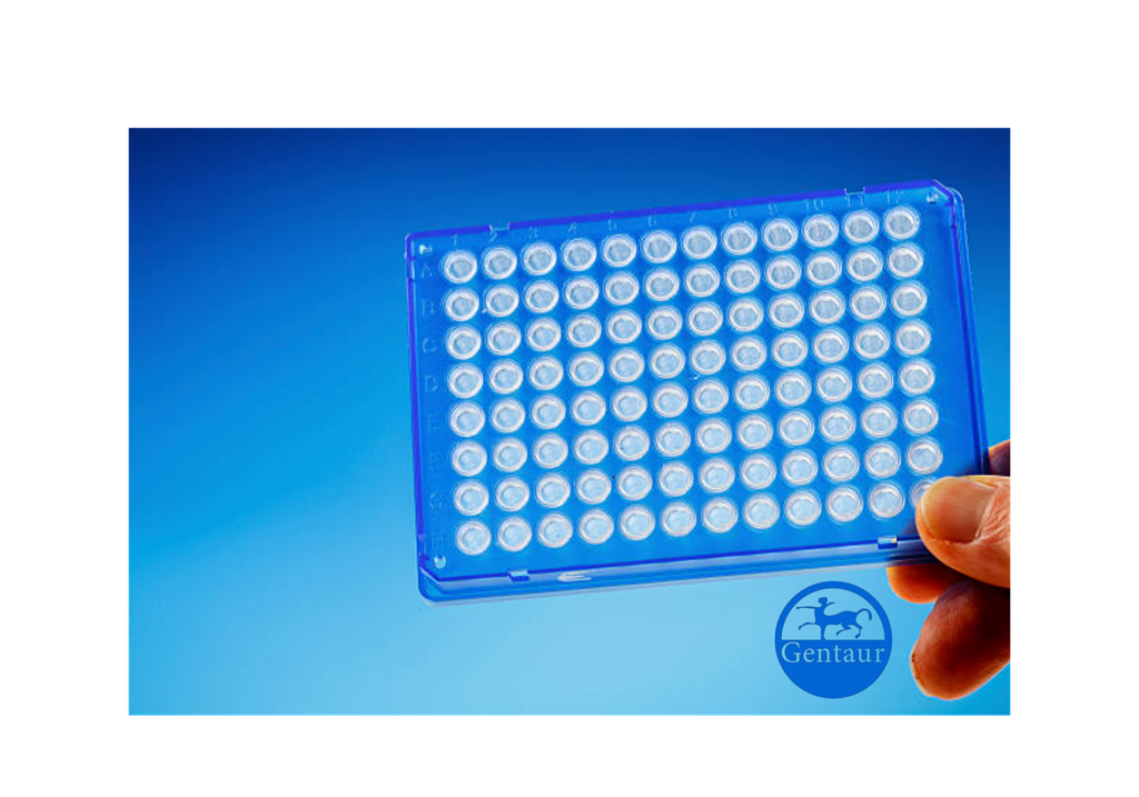 ELISA   ?-hydroxybutyryl-HIST1H3A (K18) anti-